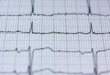 stellar cyber node 3209594307